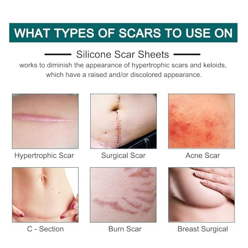 All In 1 Silicone Scar Removal Strips