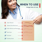 All In 1 Silicone Scar Removal Strips